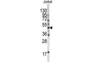 Western blot analysis of HFE antibody (Center) in Jurkat cell line lysates (35 µg/lane). (HFE Antikörper  (Middle Region))