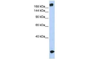 Western Blotting (WB) image for anti-Sodium Channel, Voltage-Gated, Type V, alpha Subunit (SCN5A) (N-Term) antibody (ABIN633684)