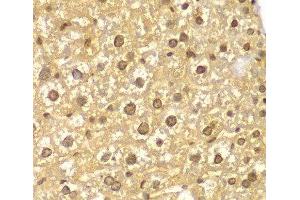 Immunohistochemistry of paraffin-embedded Mouse liver using ASC / TMS1 Polyclonal Antibody at dilution of 1:100 (40x lens). (PYCARD Antikörper)