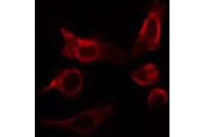 ABIN6266795 staining HepG2 cells by IF/ICC. (RHOBTB2 Antikörper)