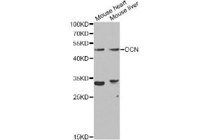 Western blot analysis of extracts of various cell lines, using DCN Antibody (ABIN5970829) at 1/1000 dilution. (Decorin Antikörper)