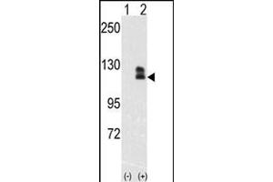Western blot analysis of EphB2(arrow) using rabbit polyclonal EphB2 Antibody (ABIN391921 and ABIN2841731). (EPH Receptor B2 Antikörper)