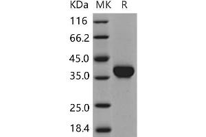 Western Blotting (WB) image for Carbonic Anhydrase X (CA10) (Active) protein (His tag) (ABIN7320151)