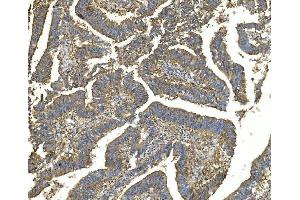 IHC analysis of EEF2 using anti-EEF2 antibody (ABIN7603141). (EEF2 Antikörper  (N-Term))