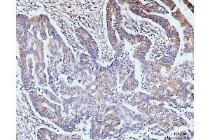 IHC analysis of GIT1 using anti-GIT1 antibody (ABIN7601683). (GIT1 Antikörper  (AA 415-736))
