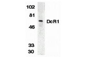 Western Blotting (WB) image for anti-Tumor Necrosis Factor Receptor Superfamily, Member 10c (TNFRSF10C) (Extracellular Domain) antibody (ABIN1030834) (DcR1 Antikörper  (Extracellular Domain))