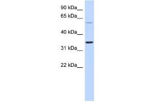 WB Suggested Anti-SASP Antibody Titration: 0. (ASPRV1 Antikörper  (Middle Region))