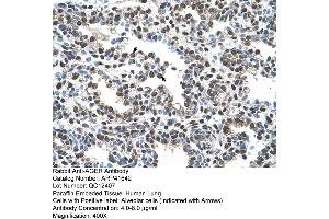 Rabbit Anti-AGER Antibody  Paraffin Embedded Tissue: Human Lung Cellular Data: Alveolar cells Antibody Concentration: 4. (RAGE Antikörper  (C-Term))