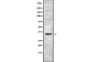 Western blot analysis OR4C12 using HuvEc whole cell lysates (OR4C12 Antikörper  (Internal Region))