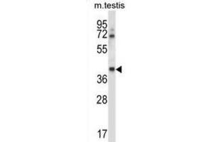 Western Blotting (WB) image for anti-Casein Kinase 1, gamma 1 (CSNK1G1) antibody (ABIN2997756) (CSNK1G1 Antikörper)