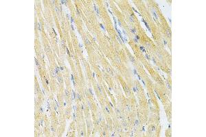 Immunohistochemistry of paraffin-embedded rat heart using GLRX Antibody (ABIN1876503) at dilution of 1:200 (40x lens). (Glutaredoxin 1 Antikörper)