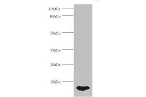 Western blot All lanes: FABP5 antibody at 5 μg/mL + HepG2 whole cell lysate Secondary Goat polyclonal to rabbit IgG at 1/10000 dilution Predicted band size: 15 kDa Observed band size: 15 kDa (FABP5 Antikörper  (AA 1-135))
