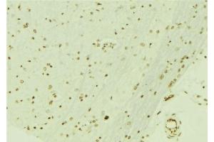 ABIN6276692 at 1/100 staining Mouse brain tissue by IHC-P. (Retinoblastoma Binding Protein 4 Antikörper  (C-Term))