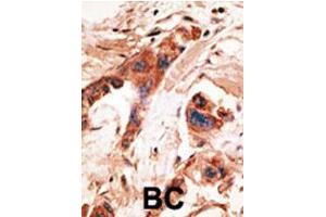 Image no. 2 for anti-BMP2 Inducible Kinase (BMP2K) (Middle Region) antibody (ABIN357190)