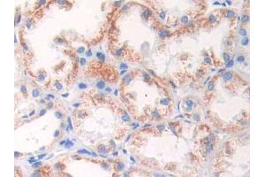 DAB staining on IHC-P;;Samples: Human Kidney Tissue (GLUD1 Antikörper  (AA 334-556))