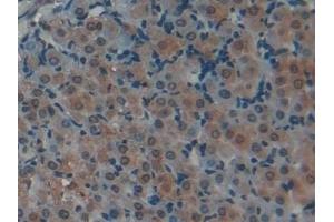 Detection of H3 in Rat Ovary Tissue using Polyclonal Antibody to Histone H3 (H3) (Histone 3 Antikörper  (AA 1-136))