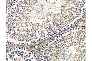 ABIN7096357 and ABIN7100419 at 1/100 staining rat testis tissue by IHC-P. (EBP Antikörper)