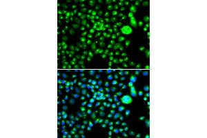 Immunofluorescence (IF) image for anti-Structural Maintenance of Chromosomes Flexible Hinge Domain Containing 1 (SMCHD1) (AA 1756-2005) antibody (ABIN6148128)