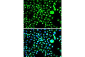 Immunofluorescence analysis of MCF-7 cells using SMCHD1 antibody. (SMCHD1 Antikörper  (AA 1756-2005))