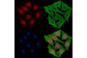 ABIN7094485 and ABIN7098534 staining Hela cells by IF/ICC.