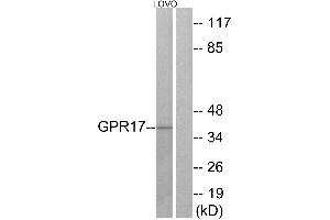 Western blot analysis of extracts from LOVO cells, using GPR17 antibody. (GPR17 Antikörper  (Internal Region))