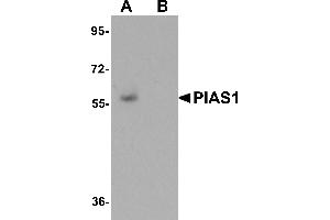 Western Blotting (WB) image for anti-Protein Inhibitor of Activated STAT, 1 (PIAS1) (C-Term) antibody (ABIN1030583) (PIAS1 Antikörper  (C-Term))