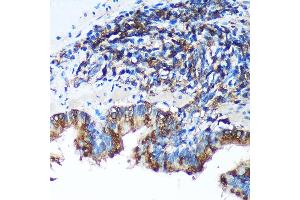 Immunohistochemistry of paraffin-embedded Rat lung using FBXO21 Rabbit pAb (ABIN7267085) at dilution of 1:100 (40x lens). (FBXO21 Antikörper  (AA 440-621))