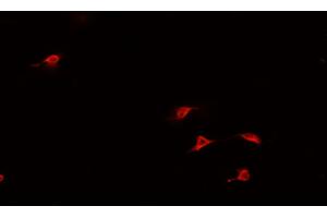 ABIN6266944 staining U-2 OS cells by IF/ICC. (HAND1 Antikörper  (Internal Region))