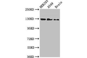 Western Blot Positive WB detected in: HEK293 whole cell lysate, A549 whole cell lysate, Mouse brain tissue All lanes: EIF4ENIF1 antibody at 2. (EIF4ENIF1 Antikörper  (AA 340-630))