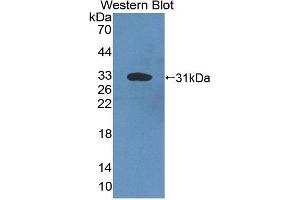 Detection of Recombinant C4, Mouse using Polyclonal Antibody to Complement Component 4 (C4) (Complement C4 Antikörper  (AA 126-366))