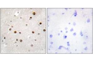 Immunohistochemistry analysis of paraffin-embedded human brain tissue, using TSN Antibody. (Translin Antikörper  (AA 101-150))