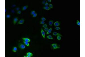 Immunofluorescent analysis of PC-3 cells using ABIN7173067 at dilution of 1:100 and Alexa Fluor 488-congugated AffiniPure Goat Anti-Rabbit IgG(H+L) (TMEM14A Antikörper  (AA 45-78))