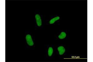 Immunofluorescence of purified MaxPab antibody to ZNF358 on HeLa cell. (ZNF358 Antikörper  (AA 1-481))