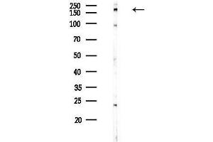 Western blot analysis of lysates from Hela cells(heat-shock,45 min treatment), using DOCK1 Antibody at 1/1000 dilution.