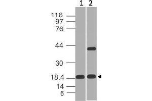 Image no. 1 for anti-Elastase 3B, Pancreatic (ELA3B) (AA 18-227) antibody (ABIN5027106) (Elastase 3B Antikörper  (AA 18-227))