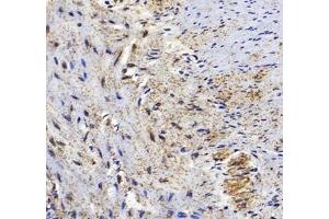 Immunohistochemistry (Paraffin-embedded Sections) (IHC (p)) image for anti-Heat Shock 60kDa Protein 1 (Chaperonin) (HSPD1) antibody (ABIN7074167)