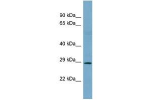 Host:  Rabbit  Target Name:  SNAI1  Sample Type:  NCI-H226 Whole cell lysates  Antibody Dilution:  1. (SNAIL Antikörper  (N-Term))