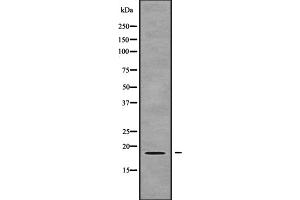 Western blot analysis of ZNHIT1 using COLO205 whole cell lysates (ZNHIT1 Antikörper  (Internal Region))