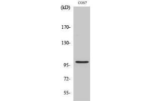 Western Blotting (WB) image for anti-AP2 associated kinase 1 (AAK1) (Internal Region) antibody (ABIN3183106)