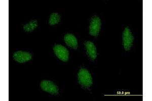 Immunofluorescence of purified MaxPab antibody to GCH1 on HeLa cell.