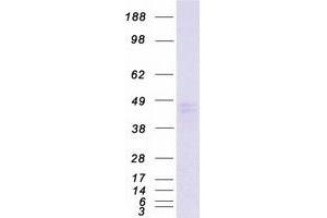 Western Blotting (WB) image for Secretory Carrier Membrane Protein 3 (SCAMP3) (Transcript Variant 1) protein (Myc-DYKDDDDK Tag) (ABIN2731437)