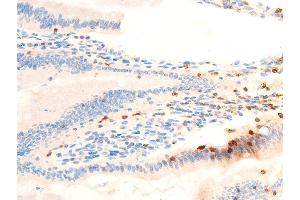 Immunohistochemistry (IHC) image for anti-Spleen tyrosine Kinase (SYK) (pTyr323) antibody (ABIN6256708)
