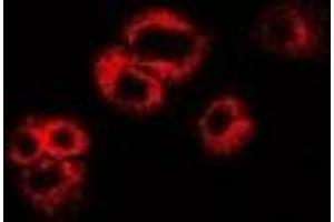 Immunofluorescent analysis of WIF-1 staining in U2OS cells.