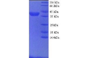 SDS-PAGE (SDS) image for Matrix Metallopeptidase 9 (Gelatinase B, 92kDa Gelatinase, 92kDa Type IV Collagenase) (MMP9) (AA 107-704) protein (His tag) (ABIN5713656) (MMP 9 Protein (AA 107-704) (His tag))