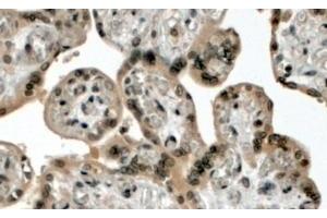 (4µg/ml) staining of paraffin embedded Human Placenta. (Lysine (K)-Specific Methyltransferase 2B (KMT2B) (N-Term) Antikörper)