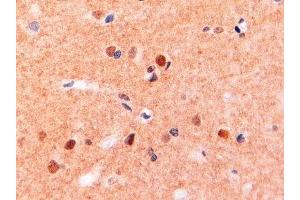 ABIN2563481 (2µg/ml) staining of paraffin embedded Human Brain. (CD11b Antikörper  (Internal Region))