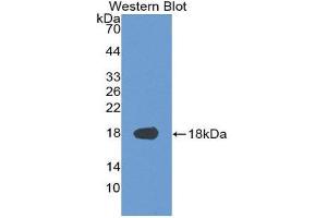 Western Blotting (WB) image for anti-Supervillin (SVIL) (AA 1385-1525) antibody (ABIN3201726) (Supervillin Antikörper  (AA 1385-1525))