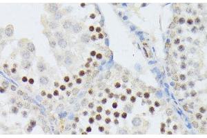 Immunohistochemistry of paraffin-embedded Mouse testis using ANKRD52 Polyclonal Antibody at dilution of 1:100 (40x lens). (ANKRD52 Antikörper)