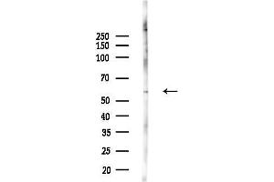 anti-Zinc Finger Protein 329 (ZNF329) (N-Term) antibody