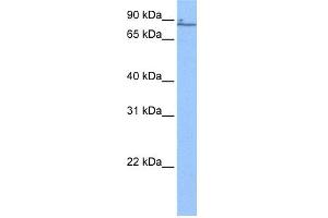 WB Suggested Anti-ZNF432 Antibody Titration:  0. (ZNF432 Antikörper  (N-Term))